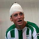 Tomáš Hrdlička dohrál s tržnou ránou na hlavě.