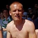 Dalibor Slezák v hledišti stadionu Viktorie Žižkov i s jizvou na ruce.